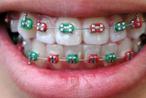 Brackets