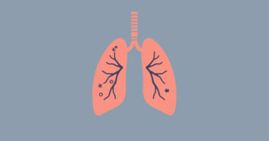 Verminous Pneumonia Caused By
