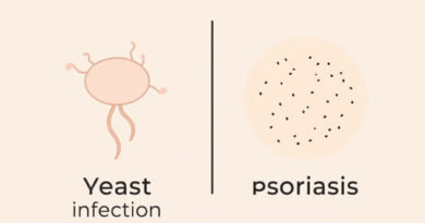 Yeast Infection Vs Psoriasis