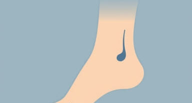 Name The Noticeable Bump On The Outside Of The Ankle